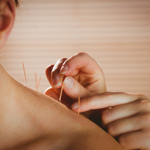 Acupuncture-Comfort-2-Cure-Nepean-ON