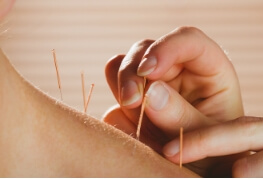 Physiotherapy Ottawa