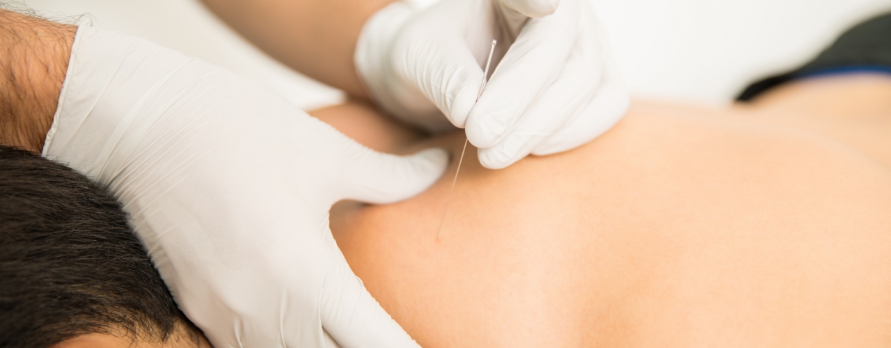 Dry-Needling-Comfort-2-Cure-Nepean-ON