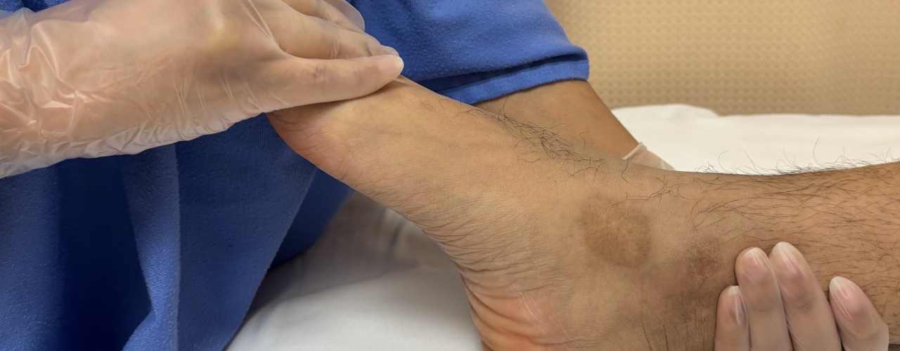 Ankle Pain Relief